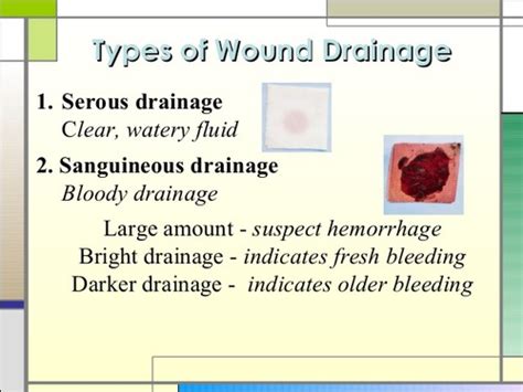 Types of Wound Drainage: Identifying Features